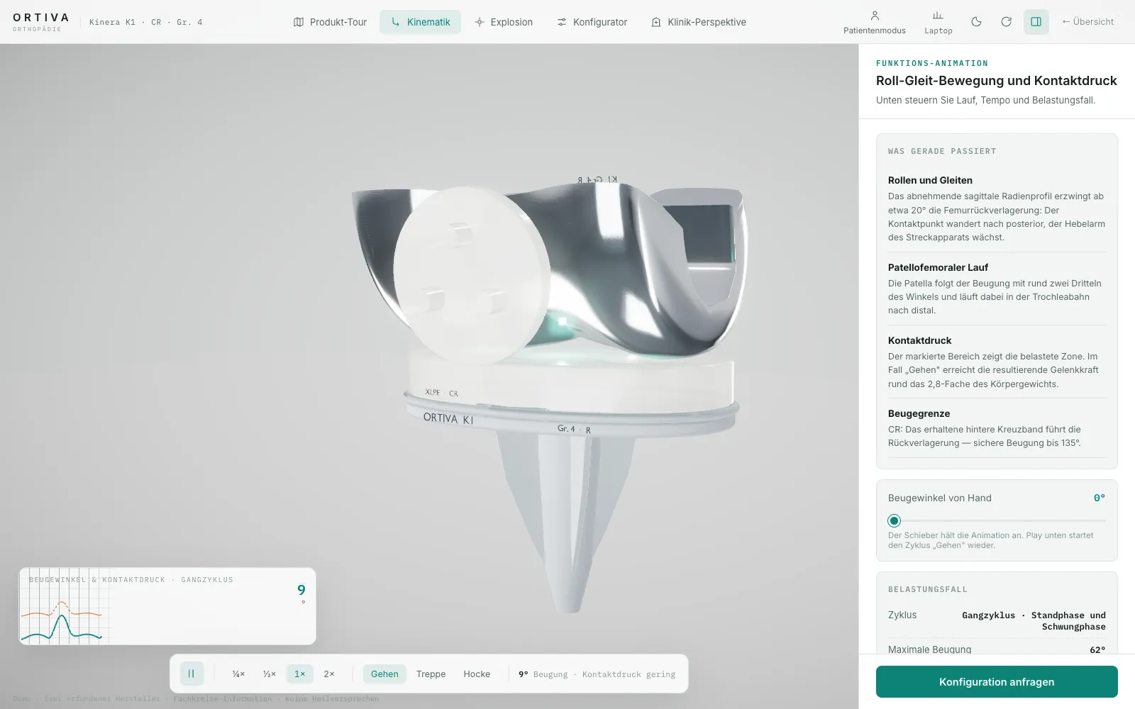 Knie-Endoprothese in 3D mit Roll-Gleit-Bewegung und Kontaktdruck auf dem Inlay