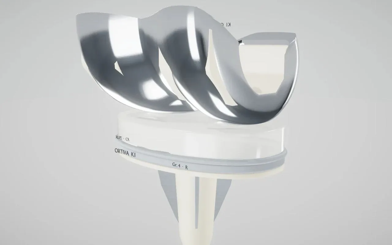 Knieendoprothese im Gelenk — Femurkomponente, Inlay und Tibiaplateau in 3D