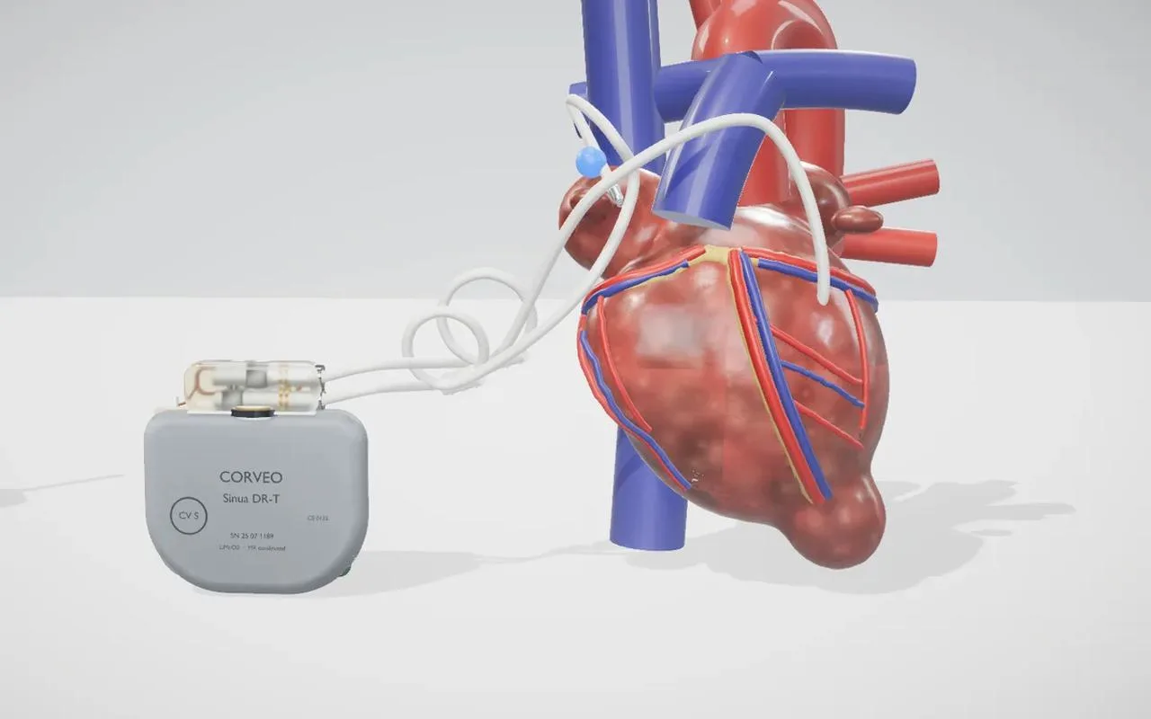 Herzschrittmacher im Schnitt — Titangehäuse, Induktionsspulen und Elektronik in 3D